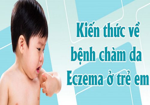 Bệnh eczema ở trẻ em: Đặc điểm và biện pháp xử lý an toàn cho bé 