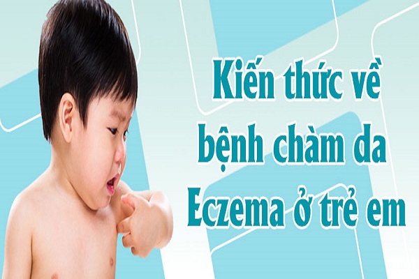 Bệnh eczema ở trẻ em: Đặc điểm và biện pháp xử lý an toàn cho bé 