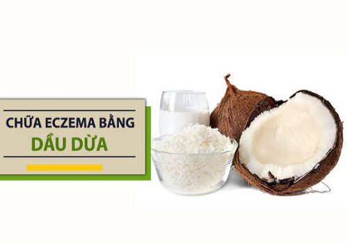 Chữa bệnh eczema bằng dầu dừa: Hướng dẫn chi tiết cách làm 