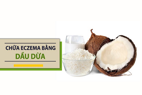 Chữa bệnh eczema bằng dầu dừa: Hướng dẫn chi tiết cách làm 