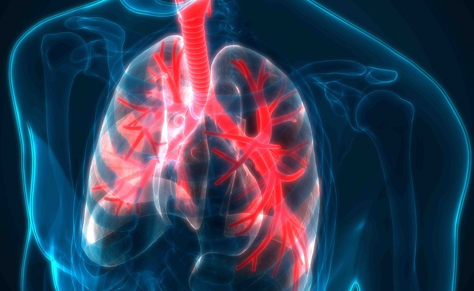 Viêm phế quản khó thở là gì? Triệu chứng, nguyên nhân và thuốc chữa trị 