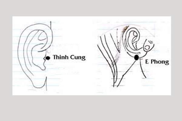 Bấm huyệt chữa ù tai ve kêu: Mẹo đơn giản và cực kì nhanh nhạy 