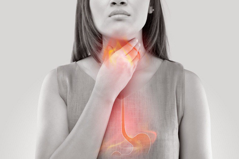 Bị ợ chua nóng rát cổ là bệnh gì? Triệu chứng và cách trị tại nhà 