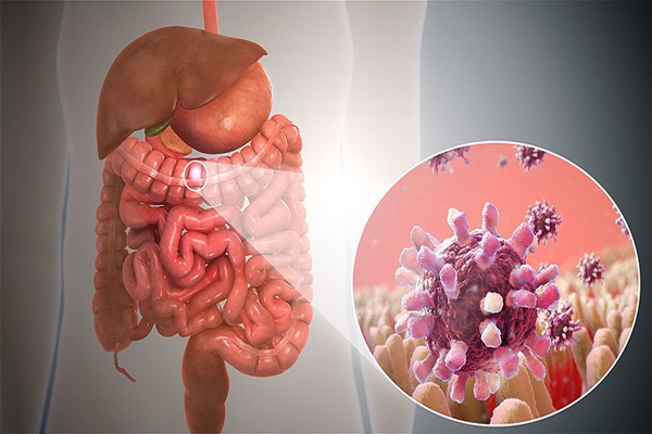 Viêm dạ dày ruột: Bệnh học và phương pháp điều trị theo phác đồ 