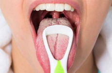 Viêm họng rêu lưỡi trắng trong miệng trông kinh làm thế nào? 
