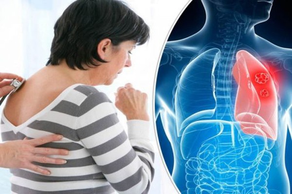 Đau sau lưng vùng phổi trái, phải là bệnh gì, liên quan hô hấp không? 