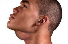 Viêm họng nổi hạch ở cổ, dưới cằm, góc hàm sau tai và đặc điểm 