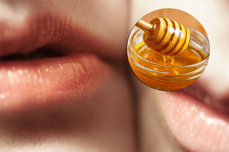 Cách trị chàm môi bằng mật ong rừng có tốt không, có hiệu quả không? 